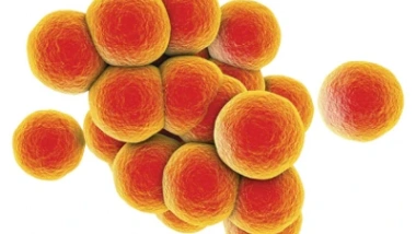 Staphylococcus aureus - symptoms of infection and treatment of staphylococcus aureus